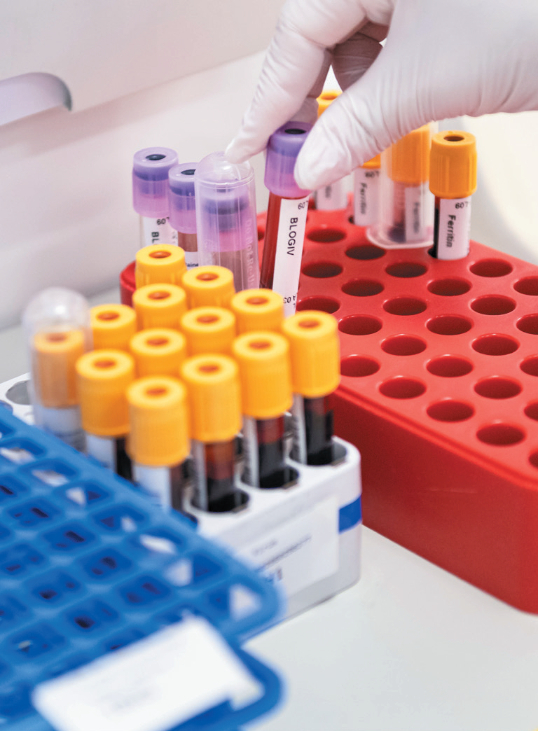 Photo of blood-tests in lab
